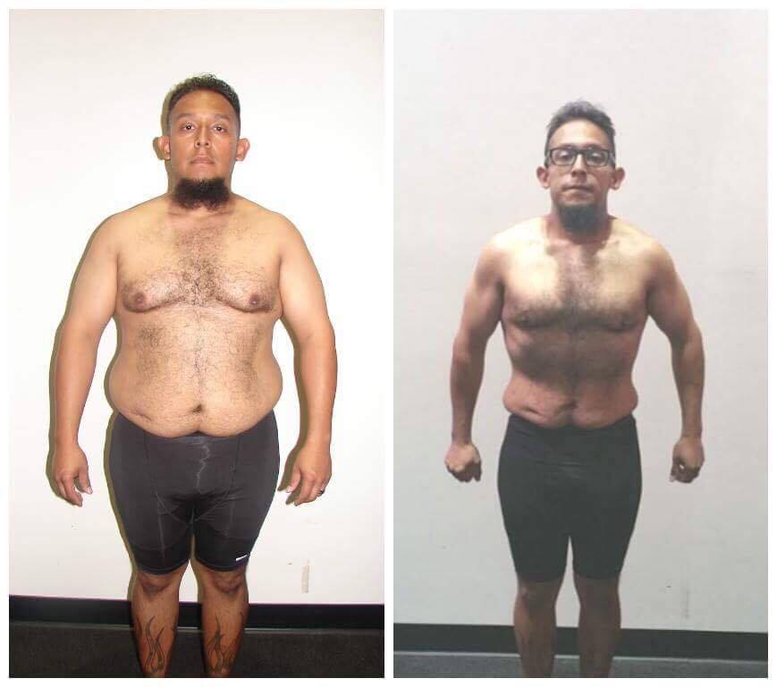 After Weight Loss Before and After Photo Gallery, Los Angeles, CA